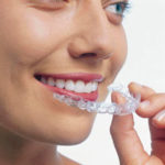 invisalign-tooth-straightening-richview-family-dentistry